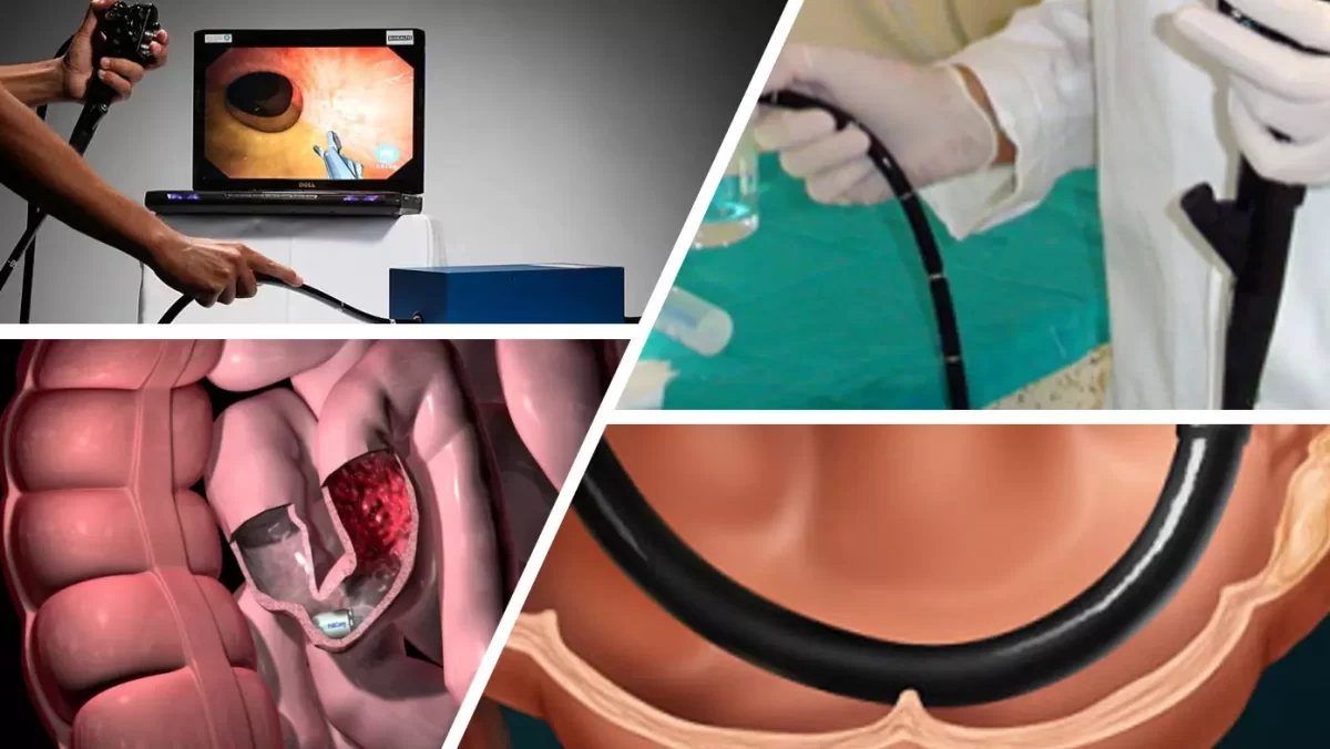 Diagnostica per immagini - Endoscopia digestiva - Colonscopia Diagnostica per immagini - Endoscopia digestiva - Colonscopia