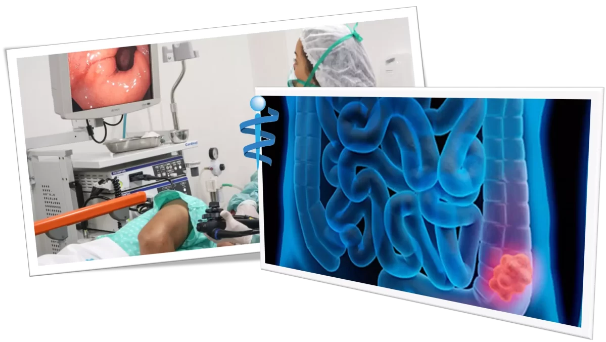 Diagnostica per immagini - Endoscopia digestiva Diagnostica per immagini - Endoscopia digestiva