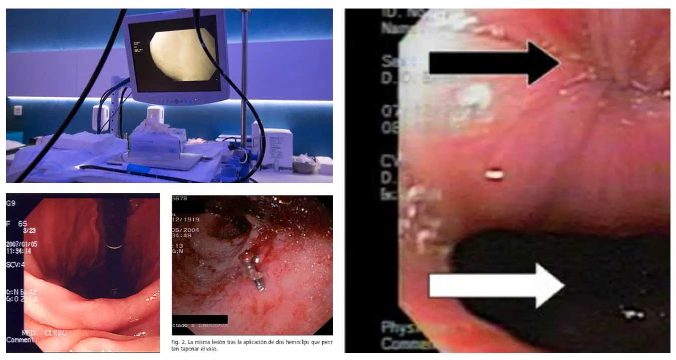 Gastroenterologia, dott. Tonino Stati, Poliambulatorio e visite specialistiche, diagnostica per immagini e Check Up - Tecnologie innovative e professionalità a Tivoli Gastroenterologia, dott. Tonino Stati, Poliambulatorio e visite specialistiche, diagnostica per immagini e Check Up - Tecnologie innovative e professionalità a Tivoli