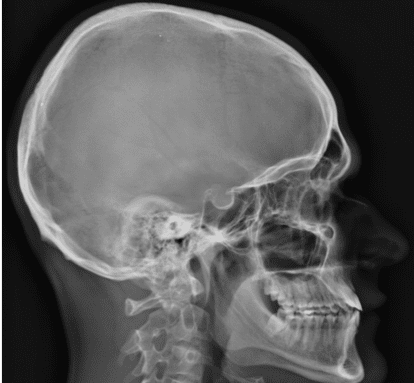 Diagnostica per immagini - Telecranio