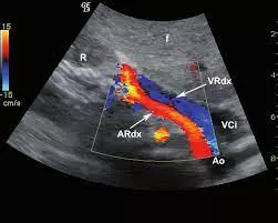 Unimed Group Srl - Poliambulatorio e visite specialistiche, Diagnostica per immagini, Check-up - Tecnologie innovative e professionalità a Tivoli - Ecografia Addome inferiore o Pelvica sovrapubica