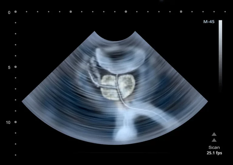 Unimed Group Srl - Poliambulatorio e visite specialistiche, Diagnostica per immagini, Check-up - Tecnologie innovative e professionalità a Tivoli - Ecografia Vescico prostatica transrettale